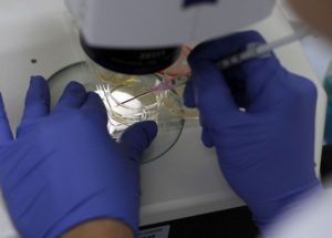 Women Were Left Blind After Stem Cell Treatment In Unapproved Clinical Trials