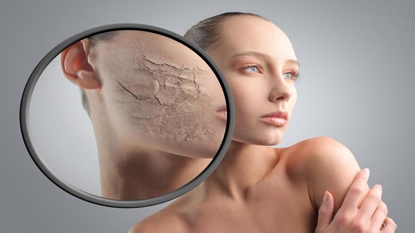 Best Natural Treatments For Dry Skin That You Can Make At Home