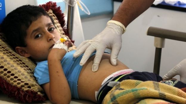 The Cases Of Cholera Have Reached A Record Number In Yemen