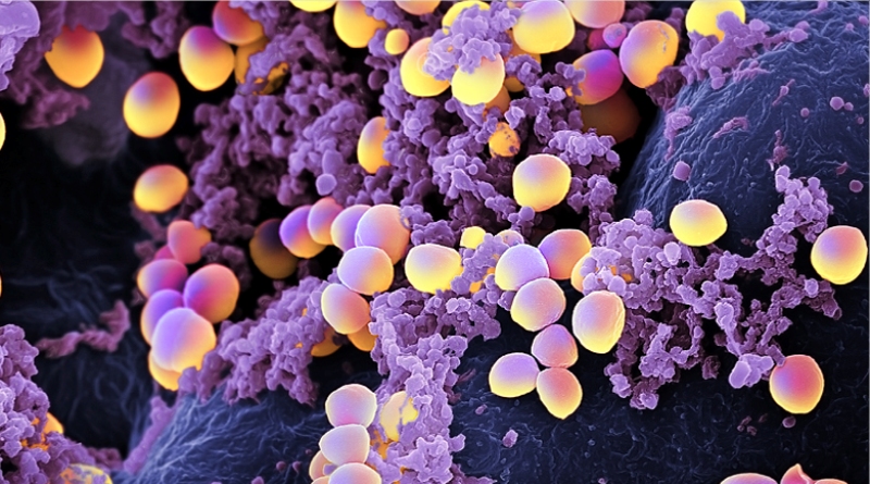 A Plant From Australia Could Cure Diseases Caused By The Staphylococcus Aureus