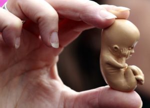 The Down Syndrome Debate – Is Terminating Pregnancies Acceptable?