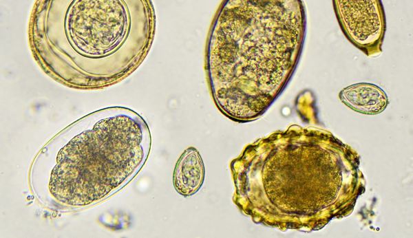 Controversial Supplement that Increases People’s Immunity can enter the Market