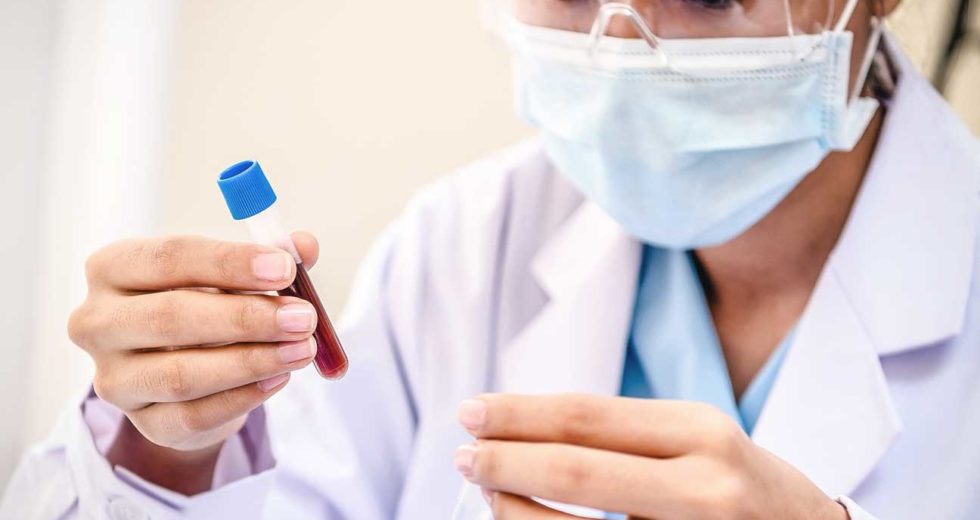 Blood Tests: Normal Ranges For Sodium Levels