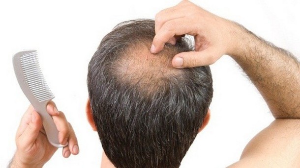 Revolutionary Hair Loss Treatment Invented By 81-Year Old Doctor
