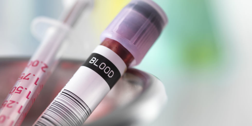 Normal Levels of Blood Tests That Detect Liver Disease