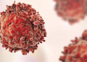Recurrent Cancer: Why Is It Coming Back After Treatment?