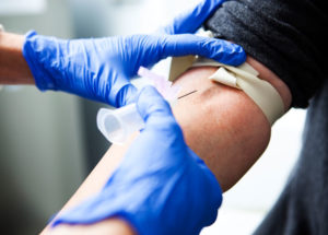 The Serum Iron Test: All You Need to Know About It and the Results