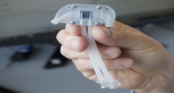 The Bionic Kidney Will Completely Replace Dialysis In The Near Future