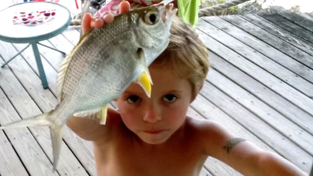 A 6-Year-Old Boy Who Got Infected With Rabies Died