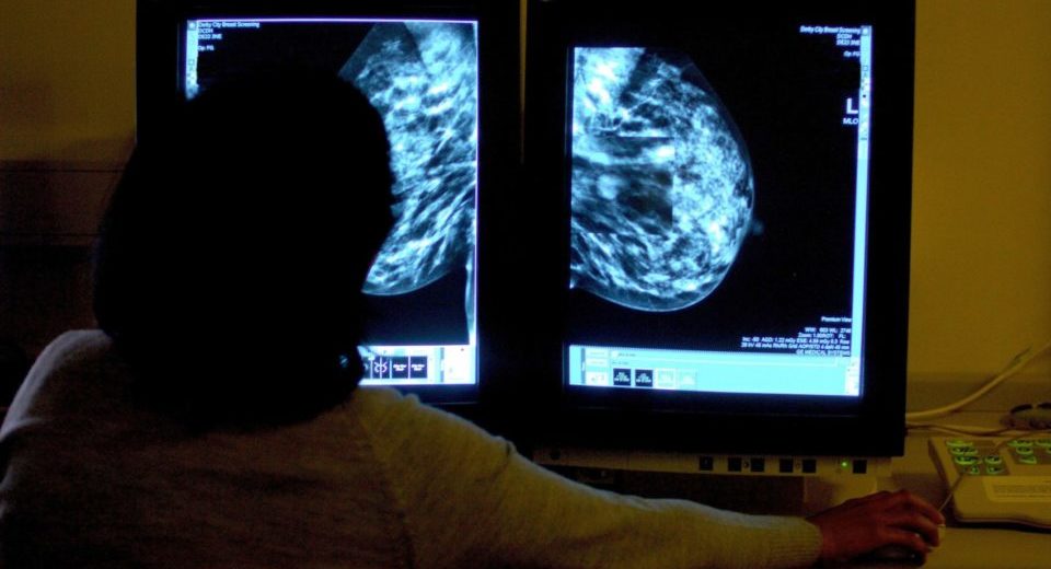 Chances of Survival When it Comes to Breast Cancer are not Affected by the BRCA Genes