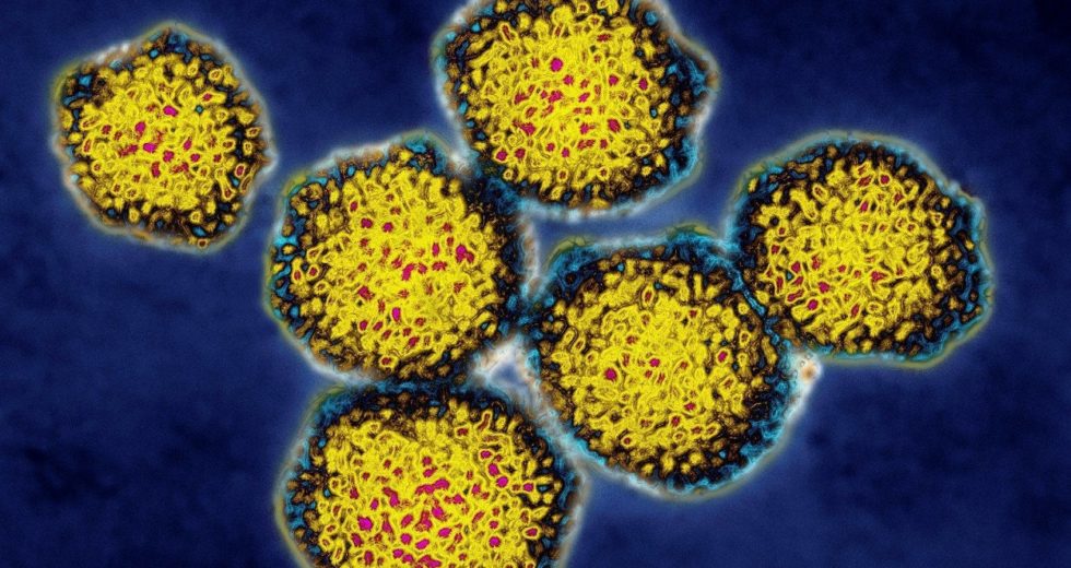 Two Restaurants in Spanish Fork, Utah, Possible Source for Hepatitis A Infection