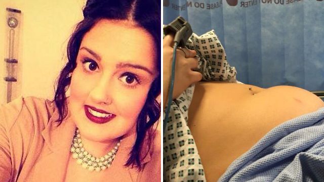 She Forgot A Tampon In For 9 Days, Toxic Shock Syndrome Almost Killed Her