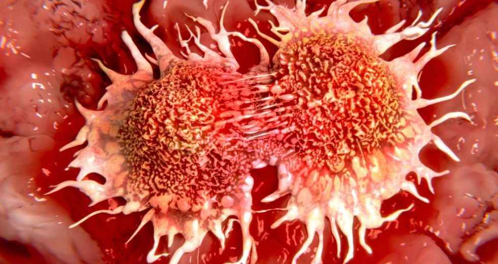 Surviving Cancer Linked To Where You Live, A New Study Revealed