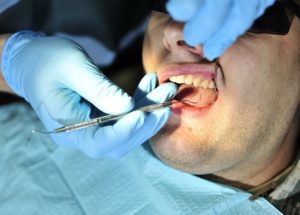 Pulling Teeth – Taiwan Supreme Court Verdict Forces Dentist to Repay Mother for Education