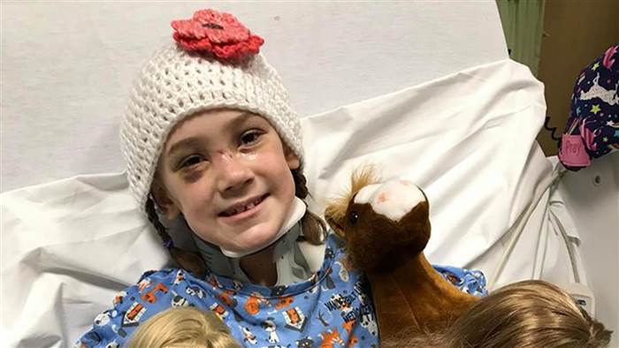 A 10-Year Old Girl Recovered From Deadly Meningitis That She Got After A Face Injury