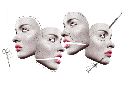 Horrific Results of Cheap Plastic Surgery Destroys Woman’s Nose