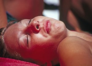 A Woman Got Second-Degree Burns After Using Banana Boat 50 Sunscreen