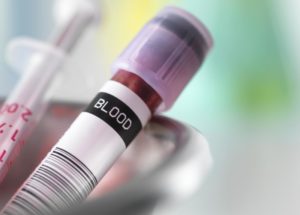 New Reasons for Which the CBC with Differential/platelet Test is Important