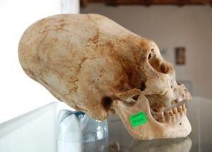 Were The Ancient Peruvians With Elongated Skulls Descendants Of Aliens?