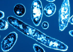 Pneumonia to be Caused by the Low Chlorine From the Water
