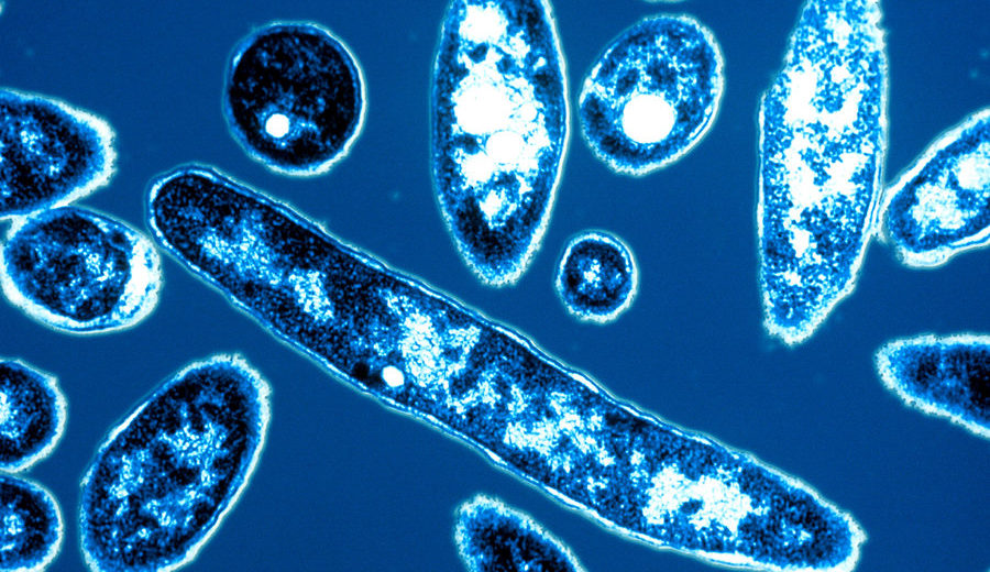 Pneumonia to be Caused by the Low Chlorine From the Water