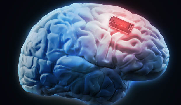 Addiction Can Be Treated With Brain Implants