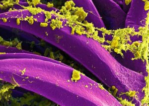 Researchers Unearthed And Studied The Black Death Plague Bacteria