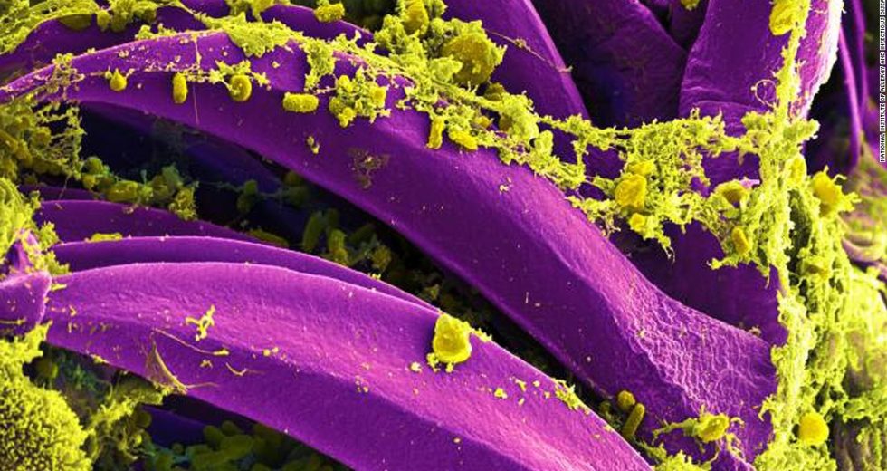 Researchers Unearthed And Studied The Black Death Plague Bacteria