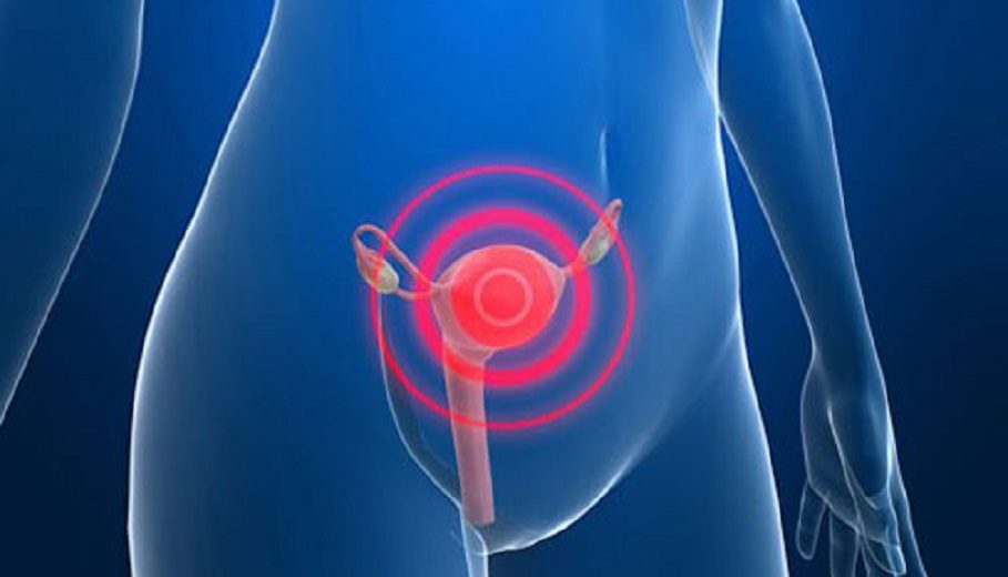 The Most Common Cervical Cancer Symptoms That No Woman Should Ignore