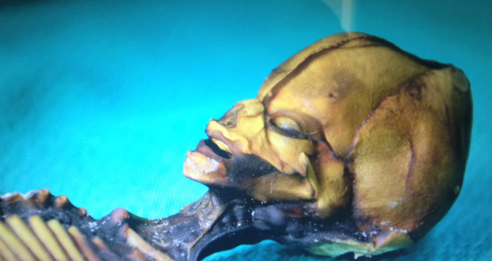 The Atacama Skeleton Is Not An Extraterrestrial Being But A Baby With Rare Mutations, A New Study Reveals