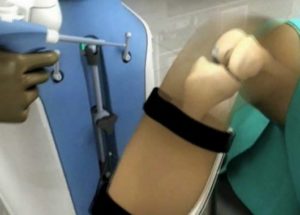 Knee Replacement Surgery to Receive a Great Aid from Robots