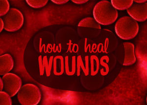 There is a New Band-Aid Out That Could Help Heal Wounds Without Leaving Scars