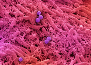 Common Skin Bacteria Protects Against Cancer