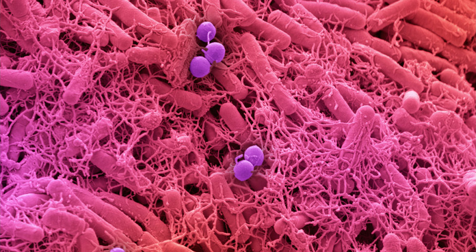 Common Skin Bacteria Protects Against Cancer