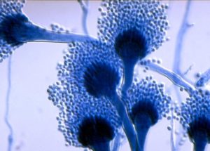 A Deadly Fungus Kills 200,000 People And Leaves Several Millions With Lung Diseases And Allergies