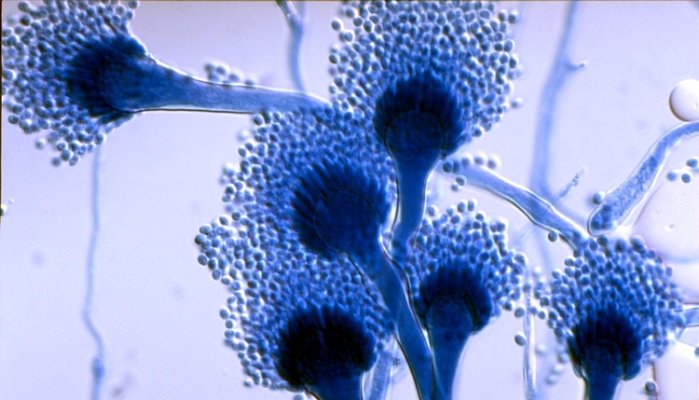 A Deadly Fungus Kills 200,000 People And Leaves Several Millions With Lung Diseases And Allergies