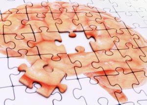 Dopamine Deficit Could Be Linked To Early Stages Of Alzheimer’s Disease Development