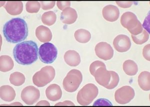 A Protein That Marks Cancer Cells Has Just Been Discovered