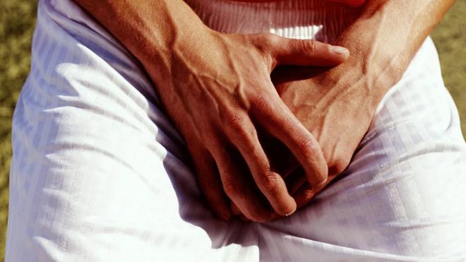 Penile Cancer Patients Refuse Amputation, The Only Life-Saving Treatment