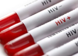 Protection Against A Virus Similar To HIV Was Obtained – Are There Hopes For A Possible HIV Vaccine In Humans?