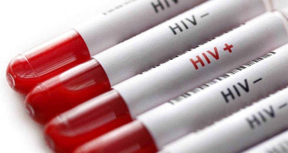 Protection Against A Virus Similar To HIV Was Obtained – Are There Hopes For A Possible HIV Vaccine In Humans?