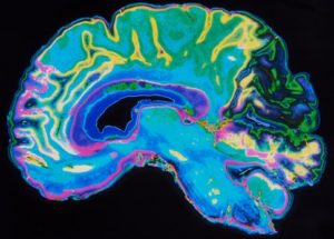 A New Non-Invasive Alzheimer’s Disease Diagnosis Has Been Discovered