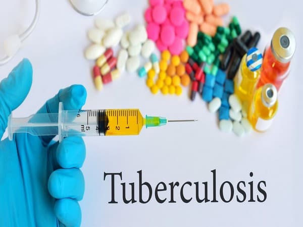 Is Tolerating Tuberculosis Better than Getting Rid of it?