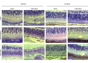 New Plan to Stop Retinal Degeneration Experimented on Mice