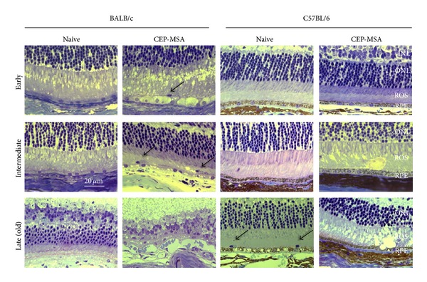 New Plan to Stop Retinal Degeneration Experimented on Mice