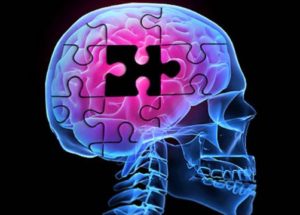 BMI1 Gene Dysfunction Is Linked To Alzheimer’s Disease Development