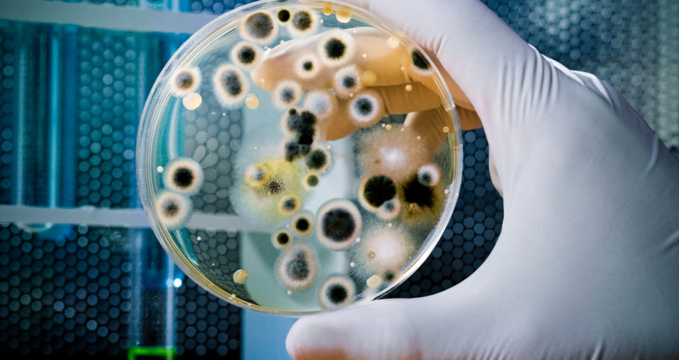 Disease Outbreaks Related To Swimming Pools And Hot Tubs Are Caused By Parasites And Bacteria