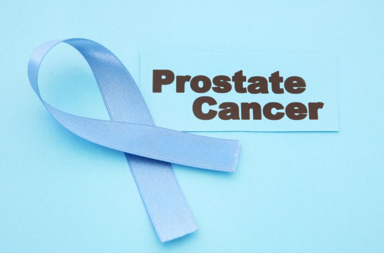 Prostate Cancer Symptoms – 5 Early Signs Of Prostate Cancer You Should Know
