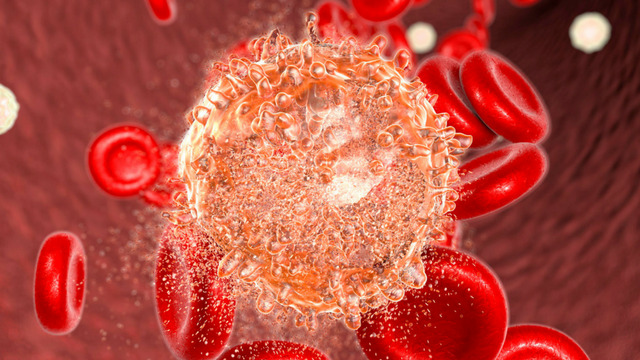 Chronic Lymphatic Leukemia Genome Has Been Deciphered By The Scientists