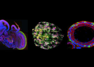 Organoids Or Mini-Organs Are The Latest Groundbreaking Discovery In Analyzing New Drugs And Treatments